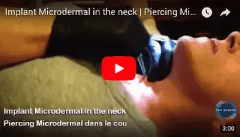 Image thumbnail YouTube d'une video où l'on voit Yan Dubord Massothérapeute Perceur qui se prépare à faire un piercing implant microdermal dans le devant du cou à son amie Sophie qui est prêt à souffrir un peu.